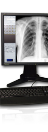 digirad DR